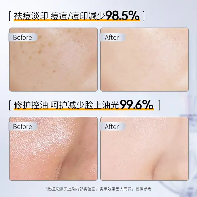 30ml