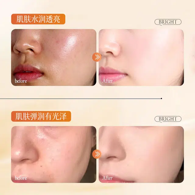 C25ml*5