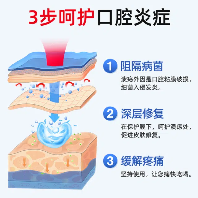 仁和 医用缓解口腔炎症含漱液清新口气牙周护理