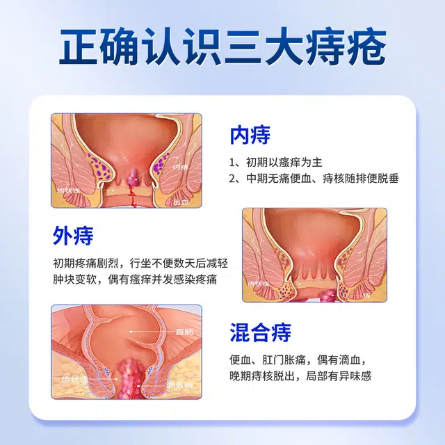 仁和 医用重组胶原蛋白痔疮凝胶 滋润消肿舒缓