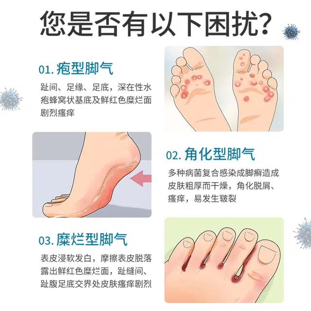 仁和 抑杀菌止痒脱皮脚丫脚臭脚气喷剂 深层清洁