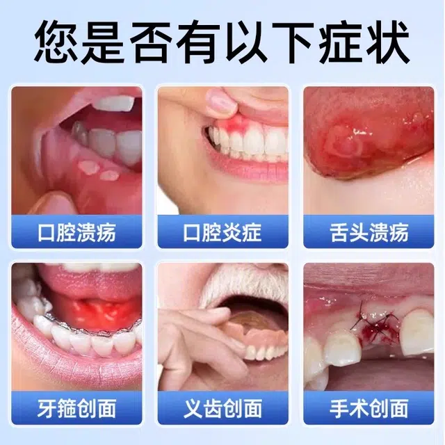 仁和 医用缓解口腔炎症含漱液清新口气牙周护理