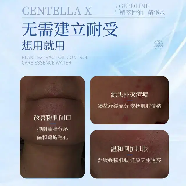 150ml