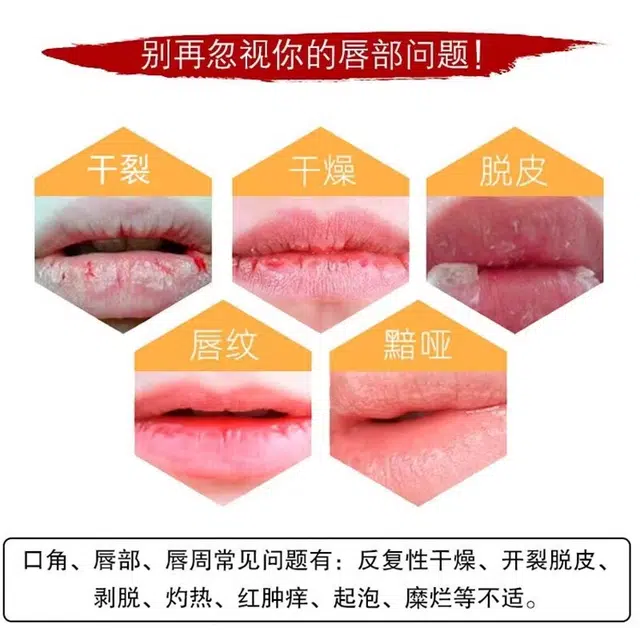 20g