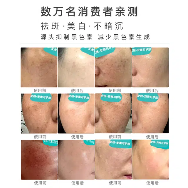 30ML