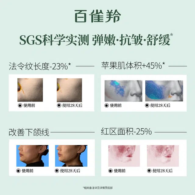 45ml