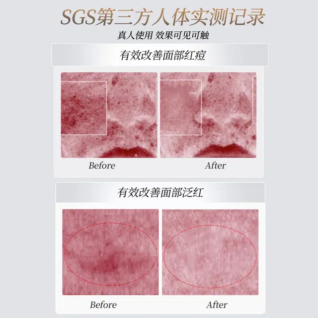 377 100g