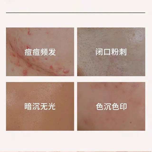 素秀臣氏视黄醇塑颜精华乳 保湿修护抗皱提亮淡纹 滋润紧致舒缓 维稳