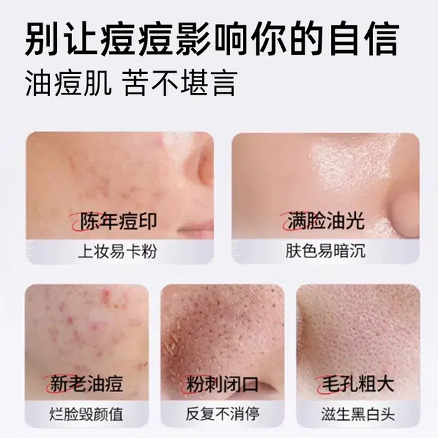 素秀臣氏  皮傲宁胶态硫净颜祛痘霜痘印毛孔粗大油痘粉刺暗沉 清爽型 舒缓 油皮混合肌