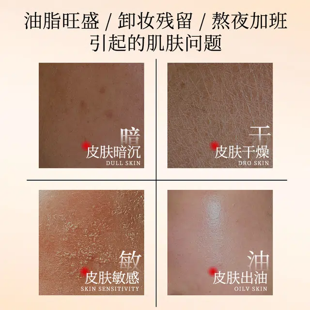素秀臣氏 层孔菌控油舒缓精华水乳套装 保湿 赠沐浴球