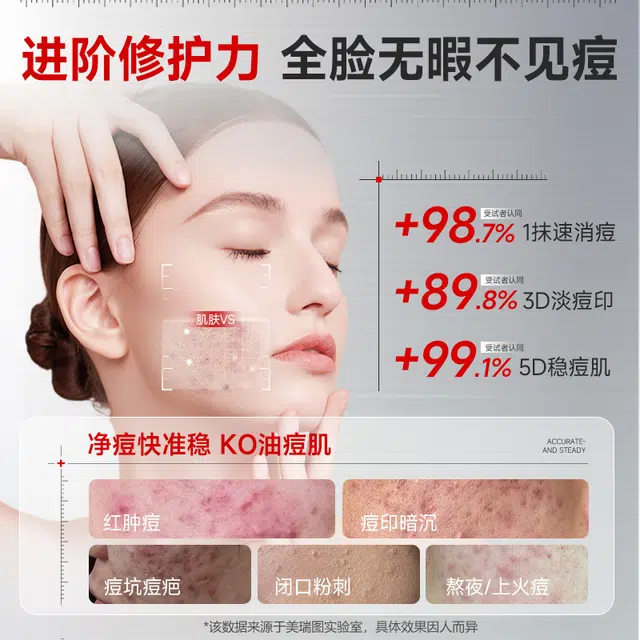 美瑞图果酸焕肤去闭口精华液 控油收缩毛孔淡痘印