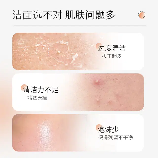 特一 美白淡斑洁面乳提亮肤色淡斑抗氧化 去黑头闭口控油清洁  淡痘印