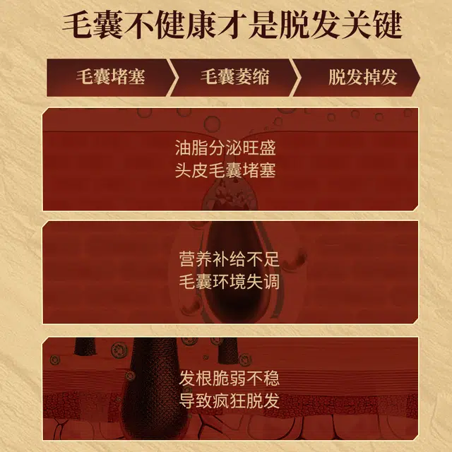 特一 防脱清爽洗发水控油清洁 止痒去屑固发  修复