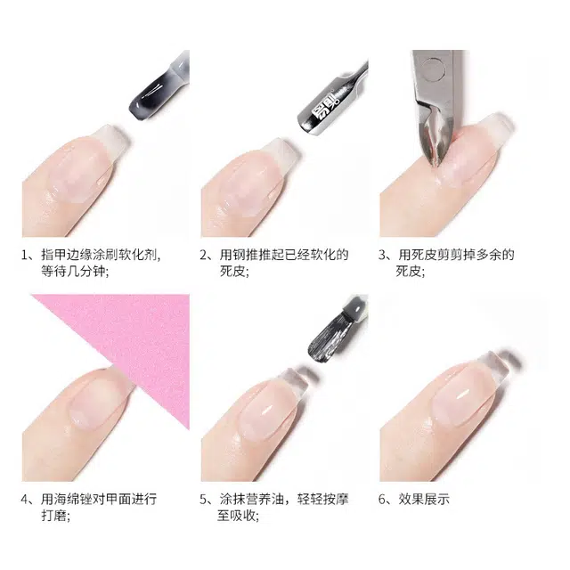 恩妮诗  死皮软化剂护理营养油套装 去角质防倒刺修手指边缘护理美甲营养油