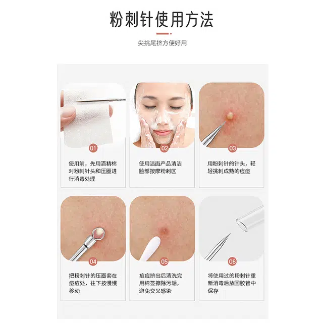 娇雪菲  超尖超细粉刺针闭口针刮黑头清暗疮针单支祛痘专用工具挑痘痘神器