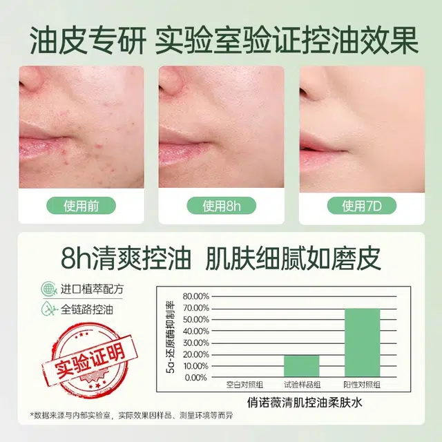 140ml120ml