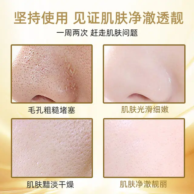 春芙 视黄醇蛇毒肽黄金面膜去黑头粉刺致收缩毛孔撕拉式泥膜 保湿 油性肤质干性肤质混合型肤质中性肤质