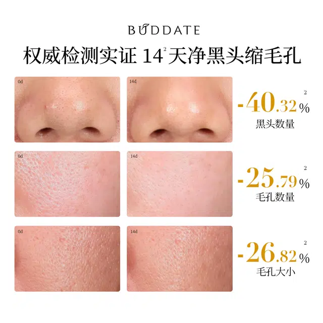 140ml