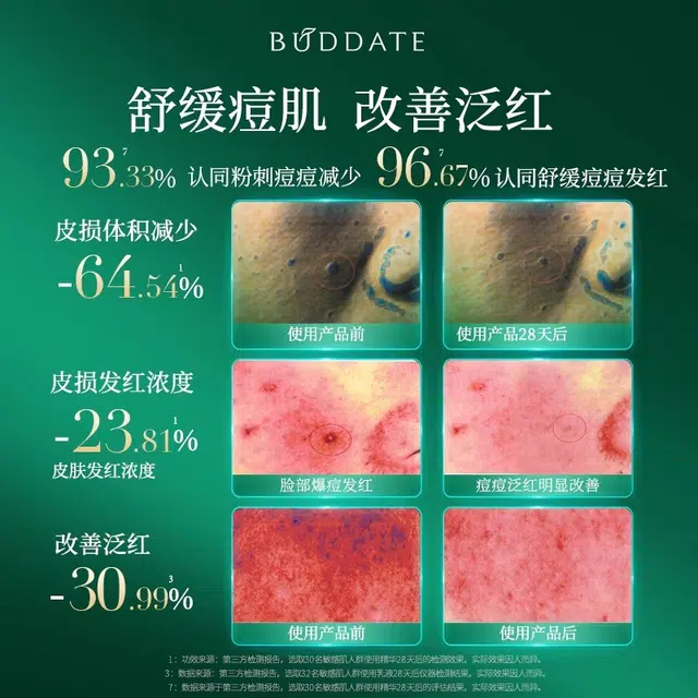 发芽时光 敏感肌改善泛红水霜组合 舒缓保湿修护 修复