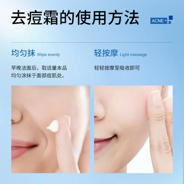 泊蝶 壬二酸祛痘膏 清肌去痘坑涂抹乳膏祛痘温和芦荟凝胶面霜 保湿淡痘印 赠竹炭去黑头膏