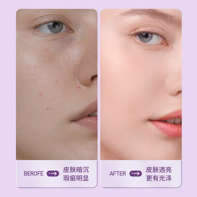 瓷雅 淡斑美白乳液 淡纹维稳提亮保湿 去黄改善暗沉淡化斑持久水润滋润