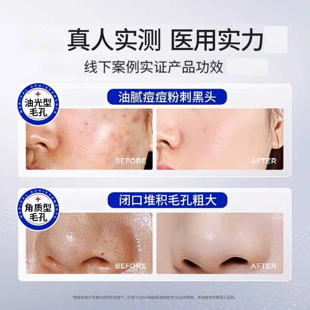 30ml