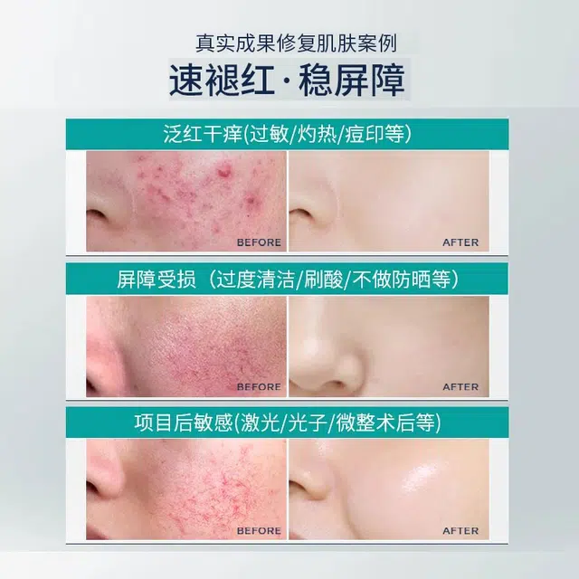 30ml