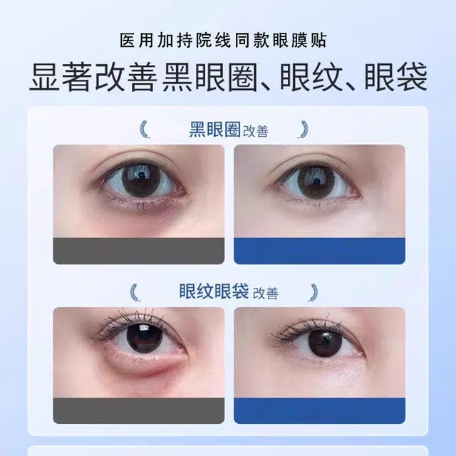 2*1010