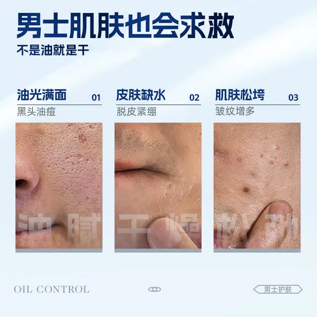 100ml