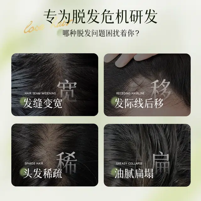 仁和匠心 防脱控油洗发水 深层清洁去头屑固发