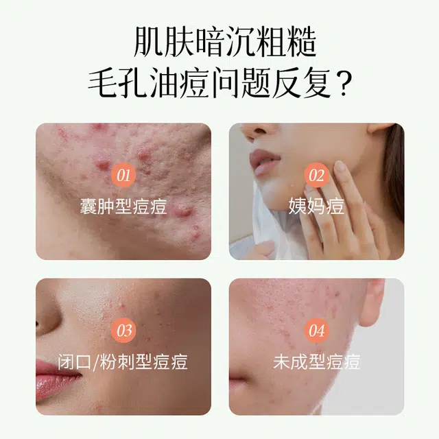 仁和匠心  水杨酸祛痘膏 控油 痘痘肌油痘肌 淡化去粉刺