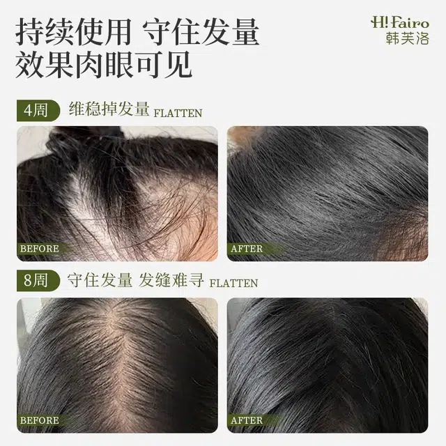 韩芙洛控油蓬松益生菌炫白亮泽洗护套装 深层清洁柔顺植物养护