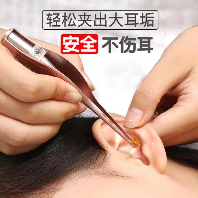 舒小奢发光耳勺带灯耳镊儿童掏耳神器掏耳勺挖耳勺采耳工具实用