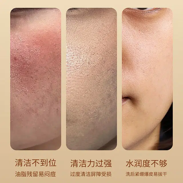DR.YMR 100g