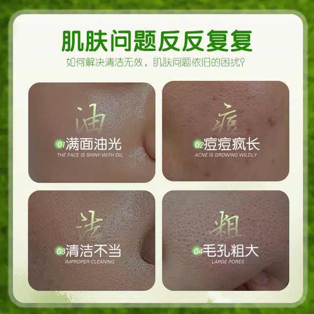 植祛 双管洁面乳 祛痘控油清洁 中性肌