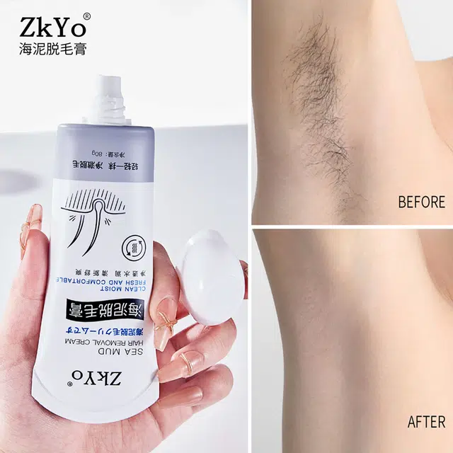 ZKYO