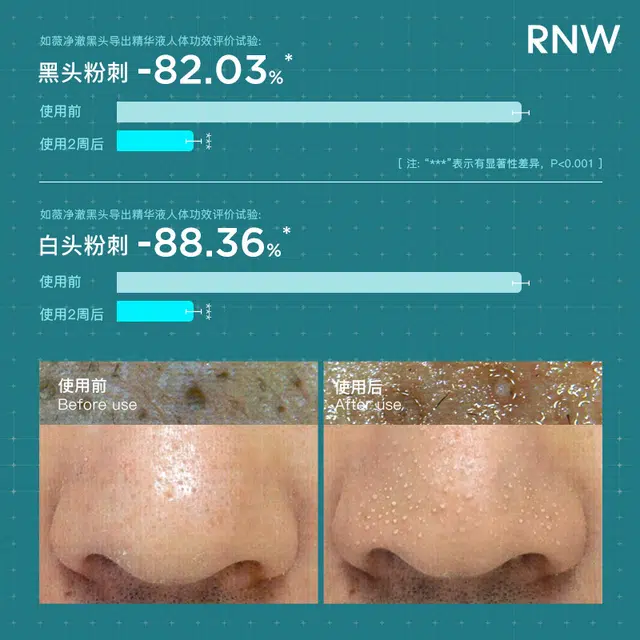 RNW100ml