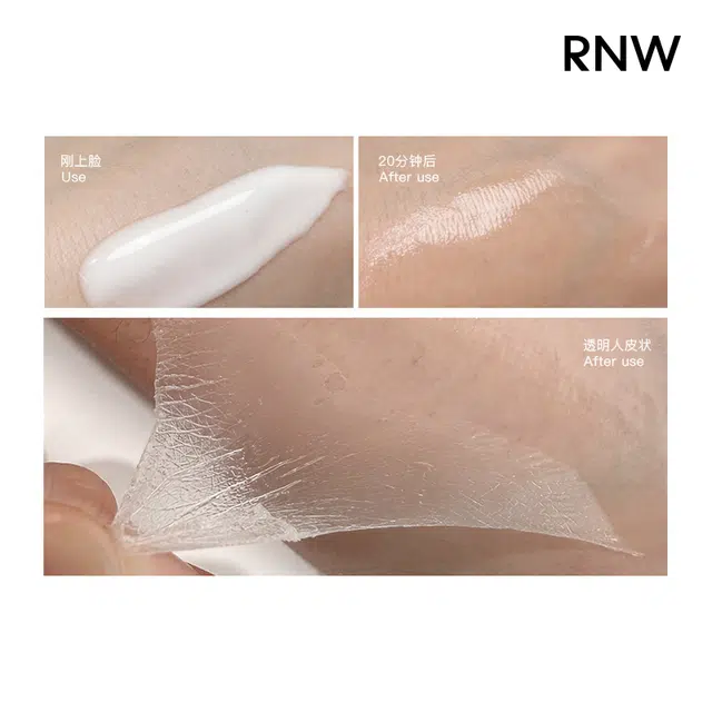 RNW