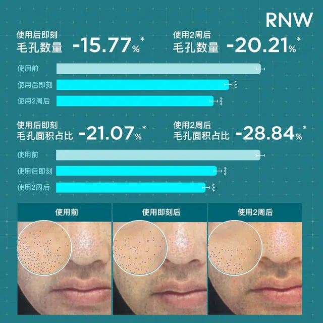 RNW100ml