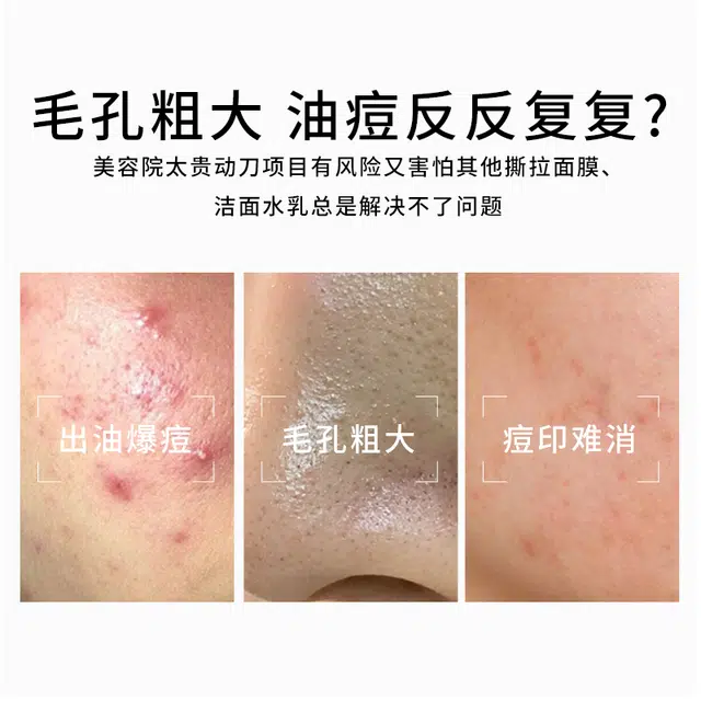 30ml