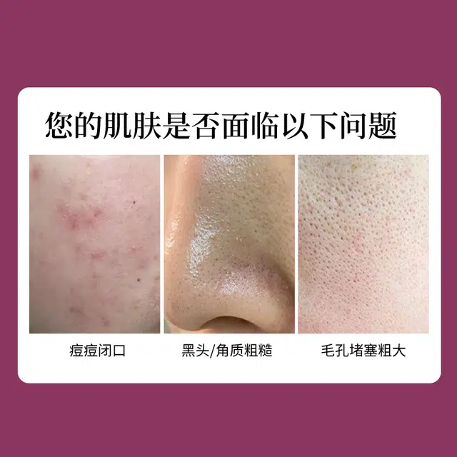 30ml