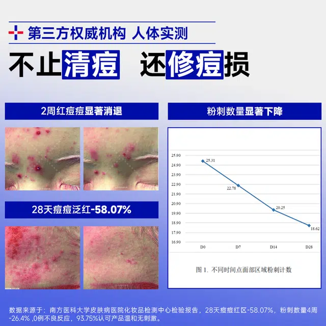 肤漾 油痘肌油橄榄 祛痘舒缓维稳淡痘印保湿补水控油祛粉刺