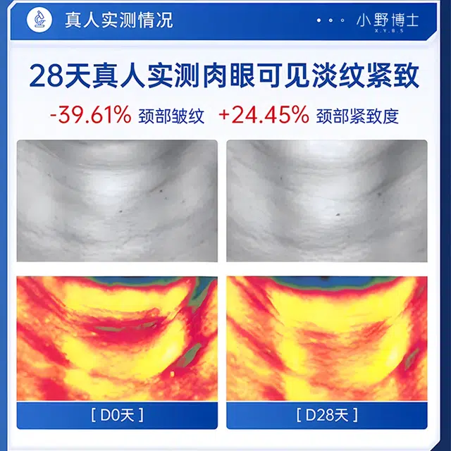 X.Y.B.S 30g30g*230g*3