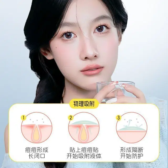浙华痘痘贴祛痘贴 隐形化妆贴痘痘净痘神器痘印水胶体人工皮敷料