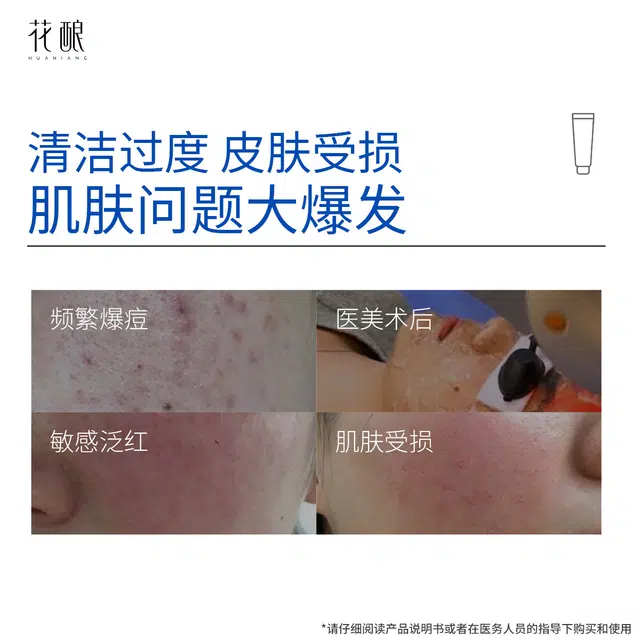 花酿 医用贻贝粘蛋白水凝胶温和洁面创面保护修护敏感肌肤保湿