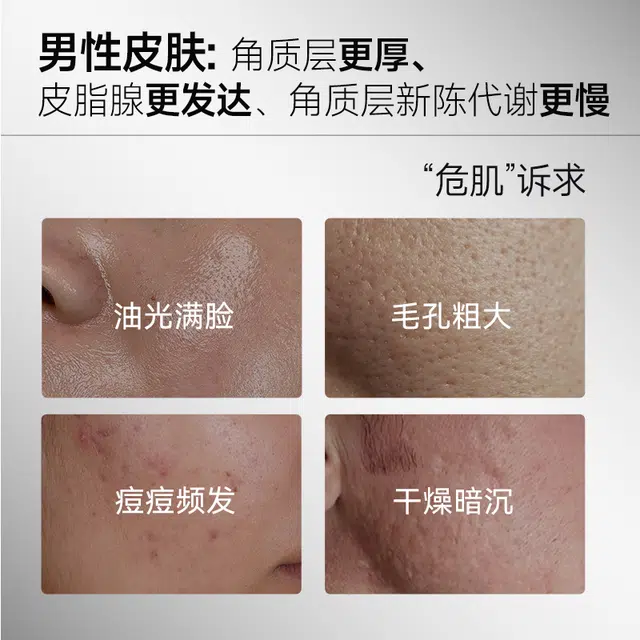 法兰琳卡 男士护肤礼盒套装 祛痘补水保湿控油清洁去角质舒缓 双管洁面水乳氨基酸泡沫洗面奶男生专用 敏感肌适用