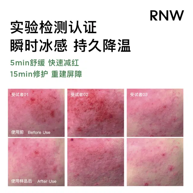 RNW
