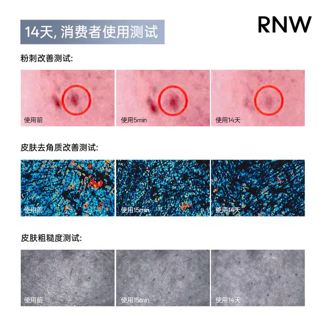 RNW 180ml