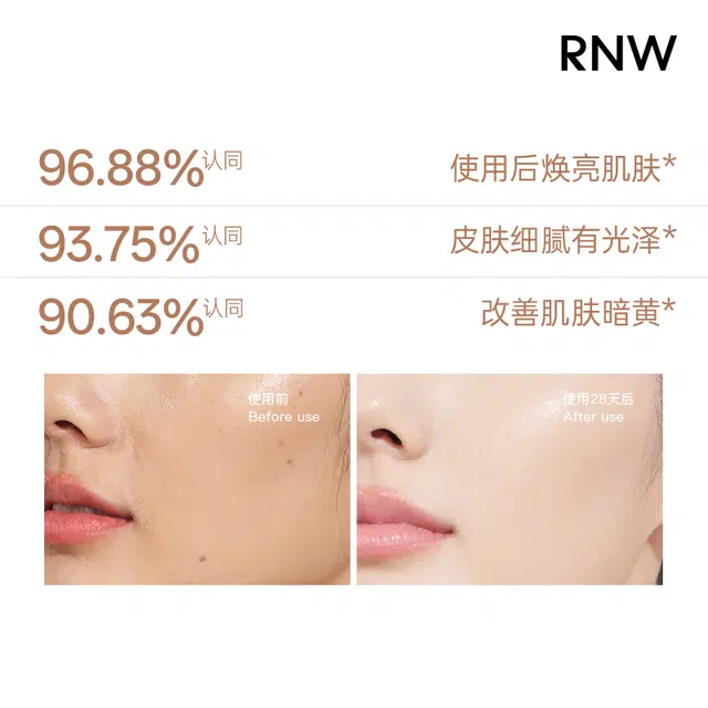 RNW