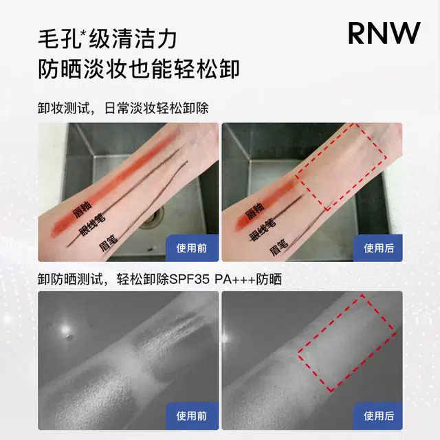 RNW